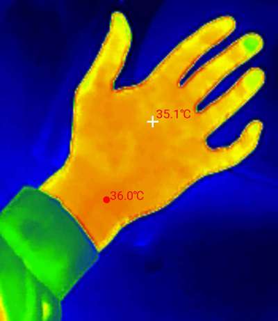 Wärmebild einer Hand